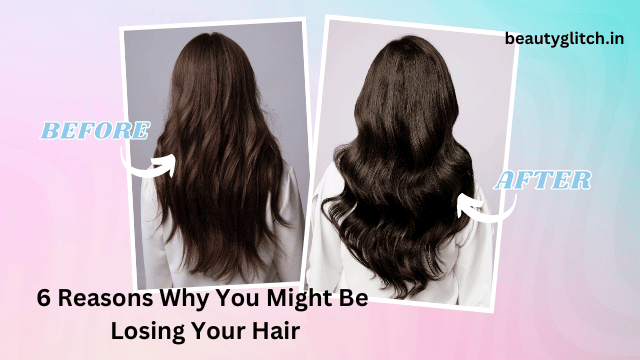 6 Reasons Why You Might Be Losing Your Hair